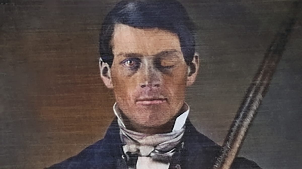 Phineas Gage