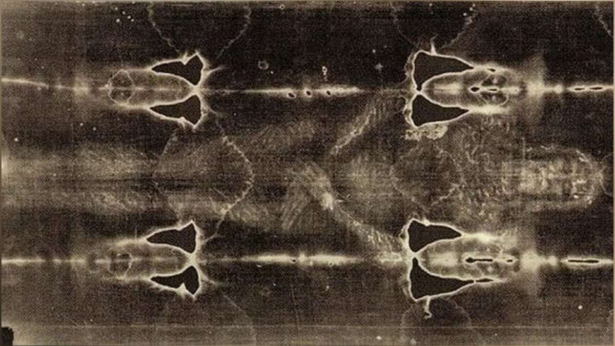 DNA Analysis of the Shroud of Turin