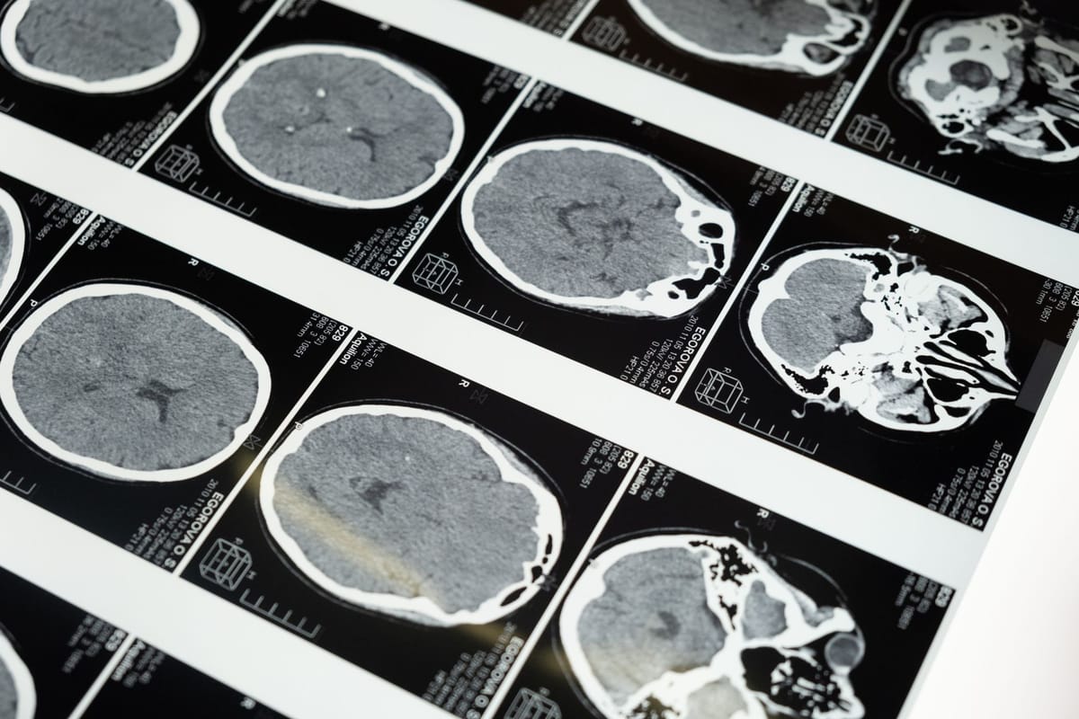 Why Our Brains Prefer Simple Explanations Even When Reality Is Complicated