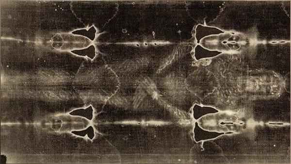 DNA Analysis of the Shroud of Turin