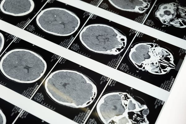 Why Our Brains Prefer Simple Explanations Even When Reality Is Complicated